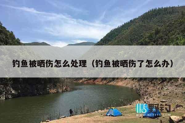 钓鱼被晒伤怎么处理（钓鱼被晒伤了怎么办）